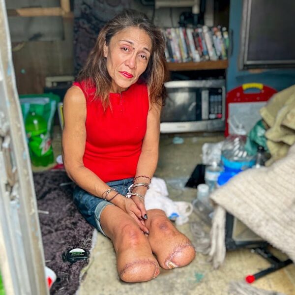 Los Angeles Homeless Woman Lost Her Legs to Frostbite