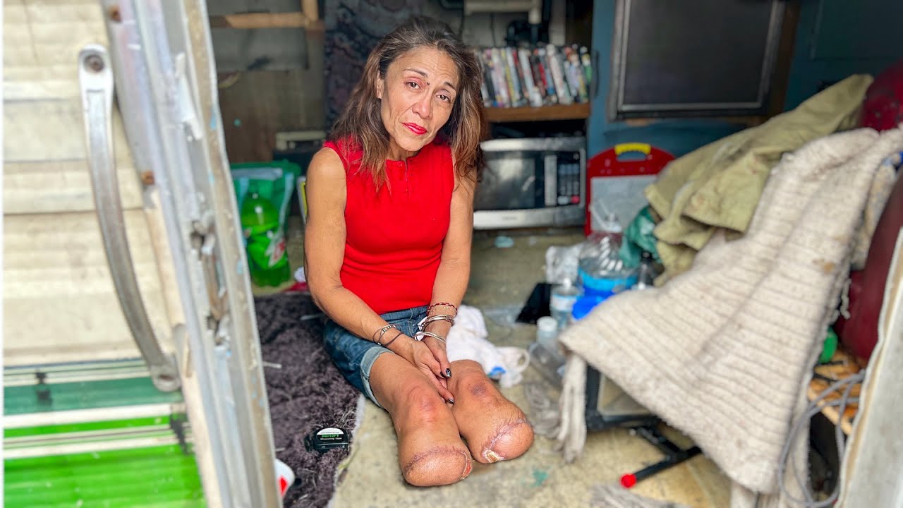 Los Angeles Homeless Woman Lost Her Legs to Frostbite